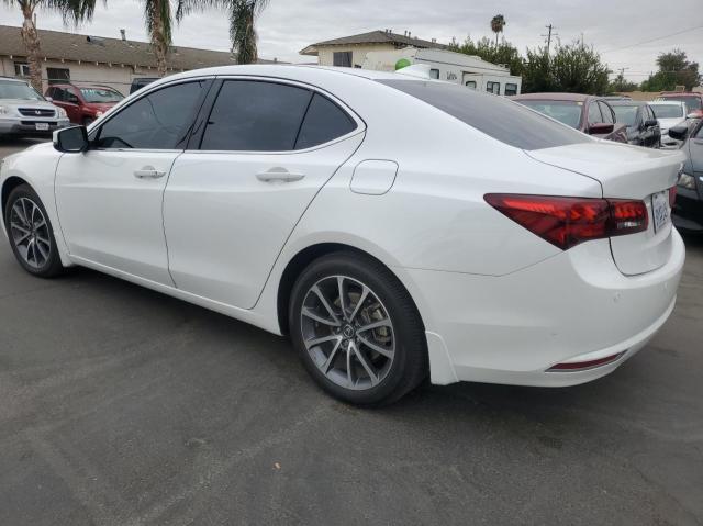 2017 ACURA TLX ADVANC 19UUB3F73HA000177