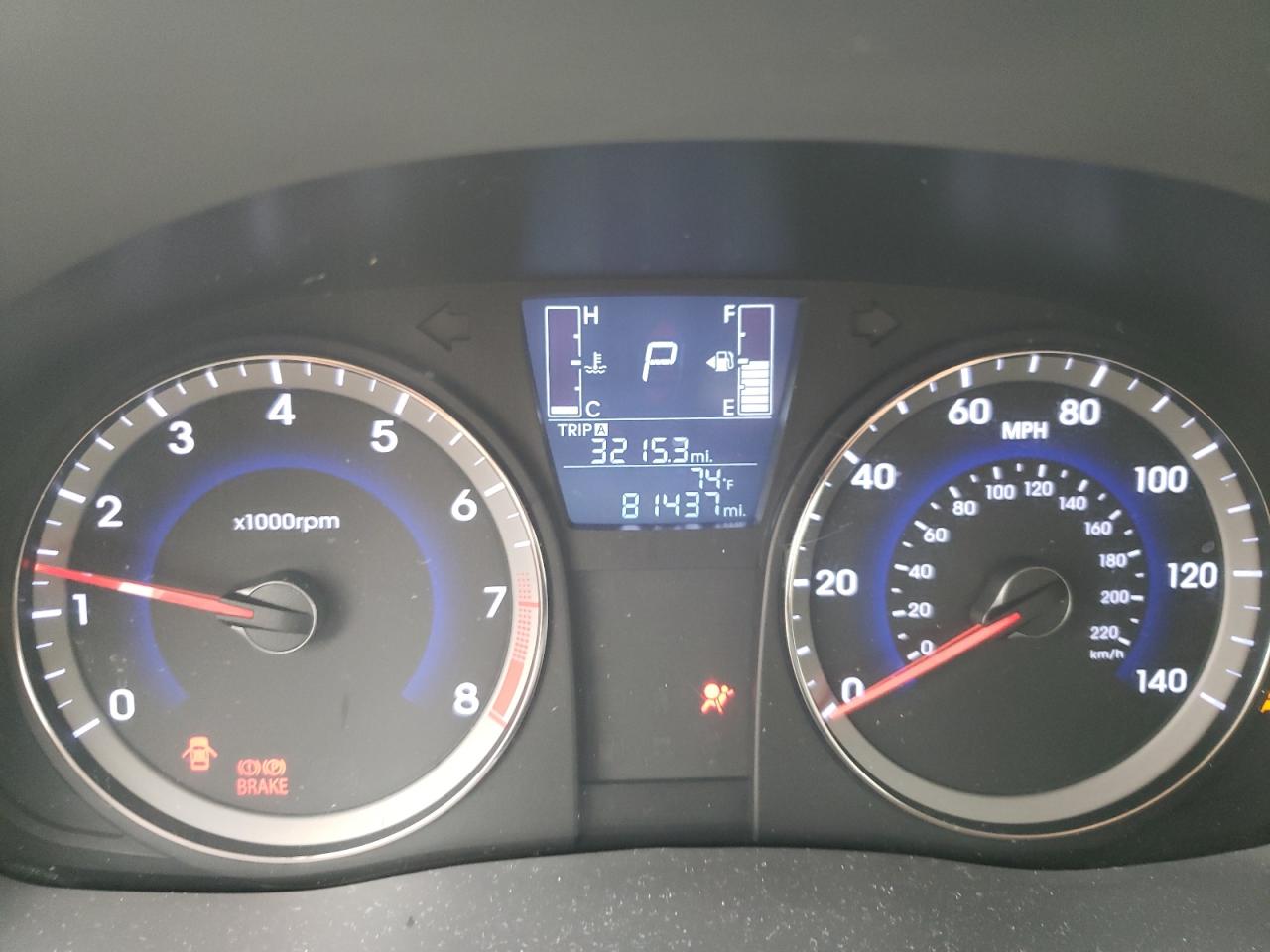 2016 Hyundai Accent Se VIN: KMHCT4AE6GU968429 Lot: 70513582