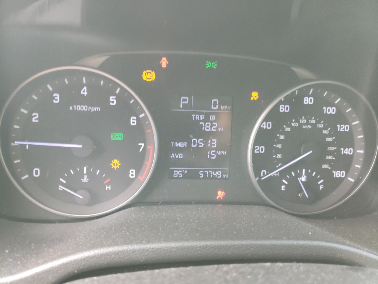 2017 Hyundai Elantra - Image 9
