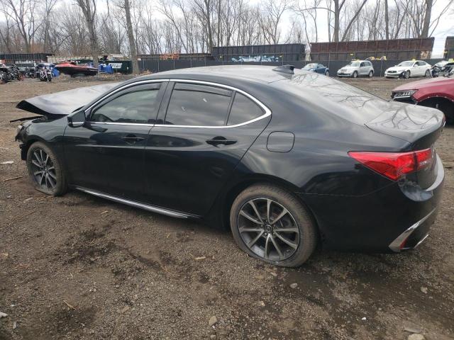 19UUB2F5XJA005665 Acura TLX TECH