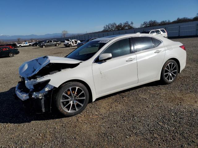 2015 Acura TLX Tech