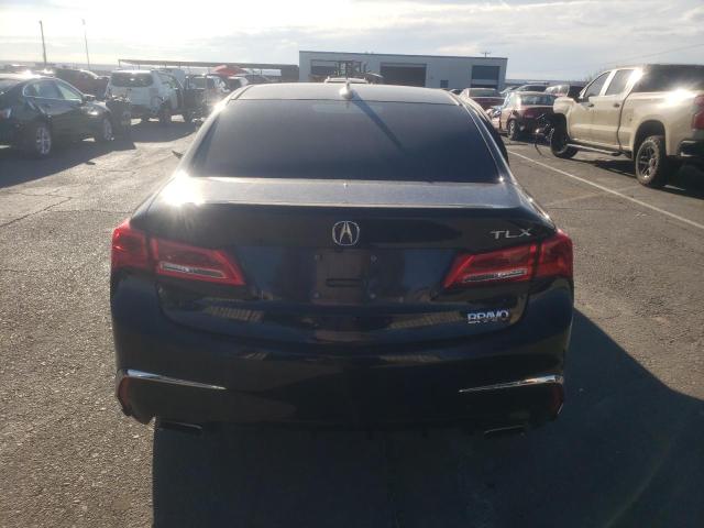 19UUB2F51JA010933 Acura TLX TECH