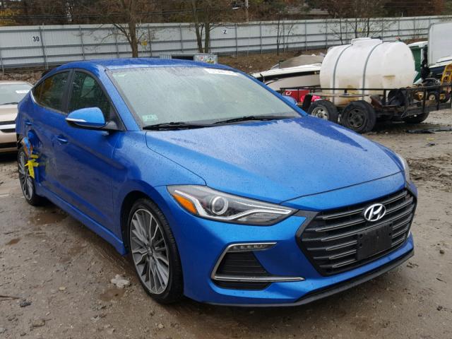 2017 Hyundai Elantra Sport For Sale Near Me Perfect Hyundai