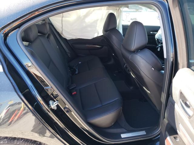 2017 ACURA TLX TECH 19UUB1F51HA009589