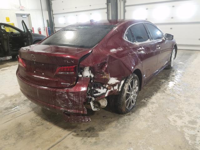 2015 ACURA TLX 19UUB3F59FA002172