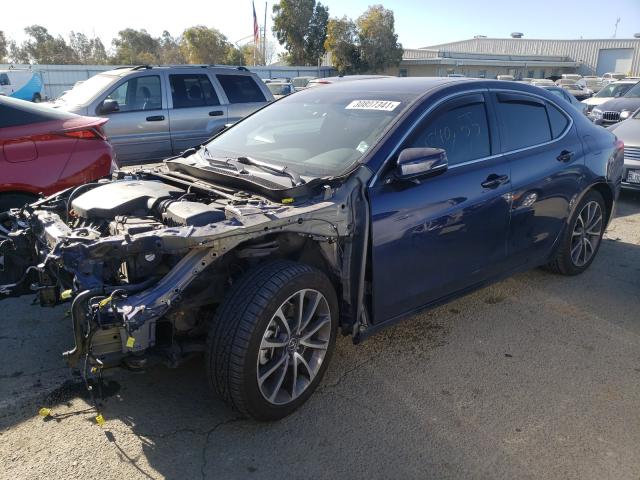 2017 ACURA TLX ADVANC 19UUB3F72HA003569
