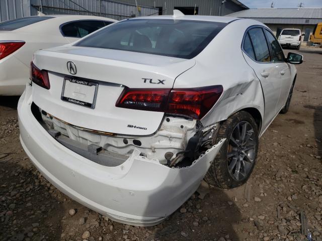 2015 ACURA TLX ADVANC 19UUB3F76FA007430
