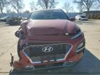 2020 Hyundai Kona Ultimate for Sale in Sacramento, CA - Front End