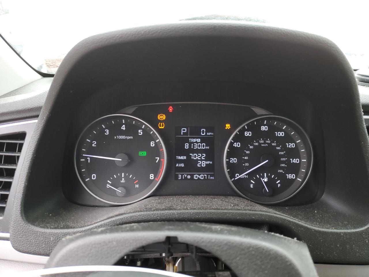 2017 Hyundai Elantra - Image 9