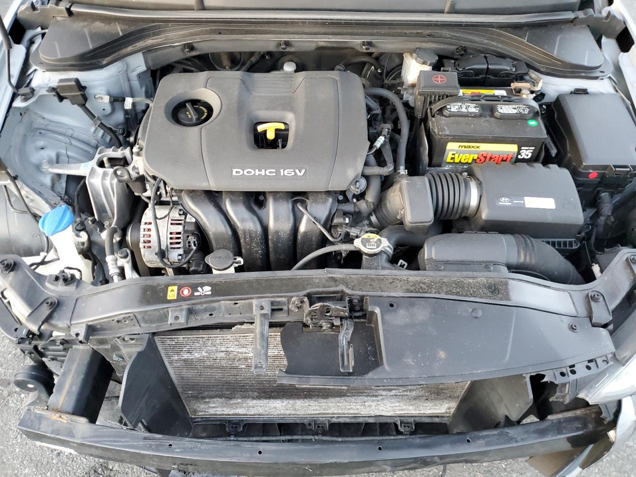 2017 Hyundai Elantra - Image 11