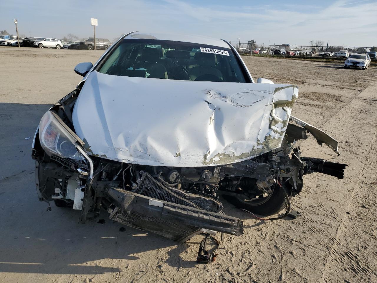 2015 Hyundai Sonata - Image 5