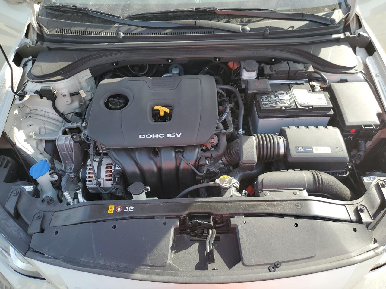 2017 Hyundai Elantra - Image 11