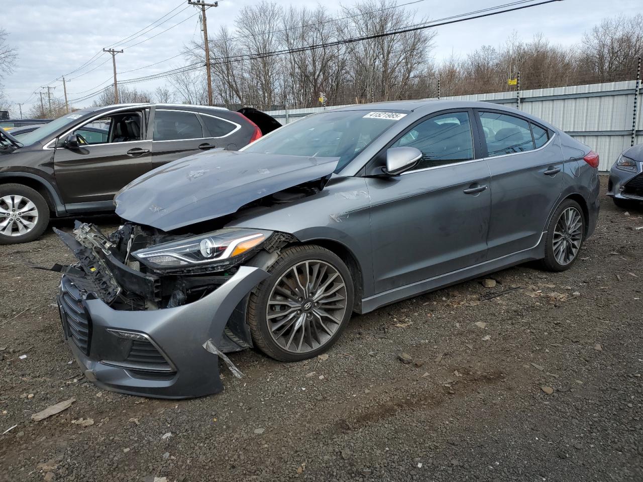 2017 Hyundai Elantra - Image 1