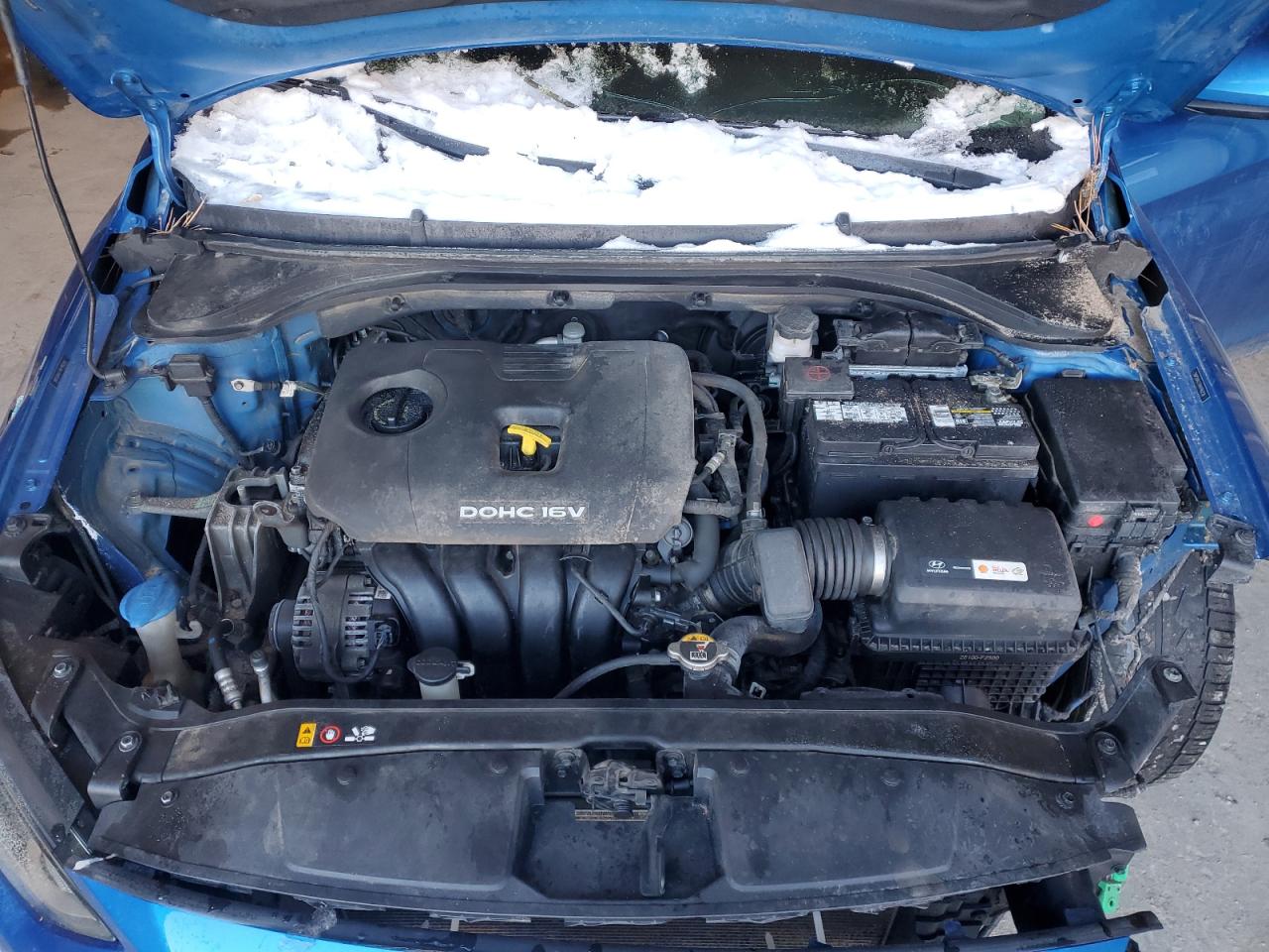 2017 Hyundai Elantra - Image 11