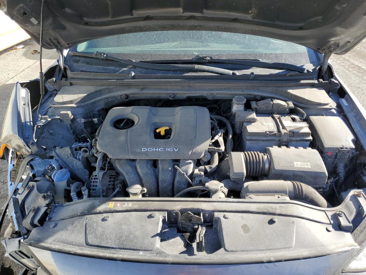 2017 Hyundai Elantra - Image 11