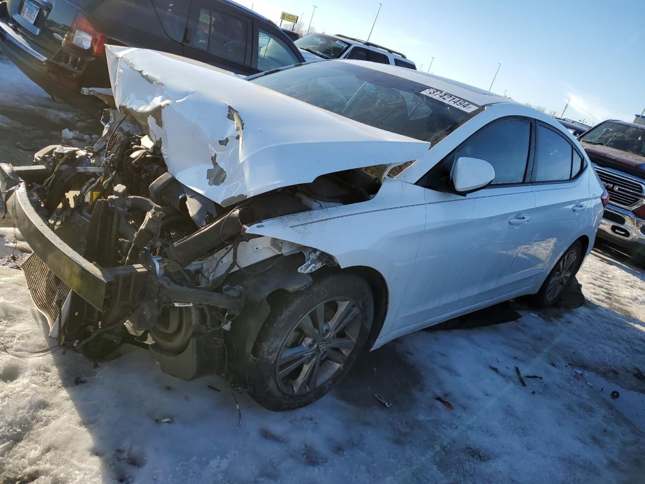 2017 Hyundai Elantra - Image 1