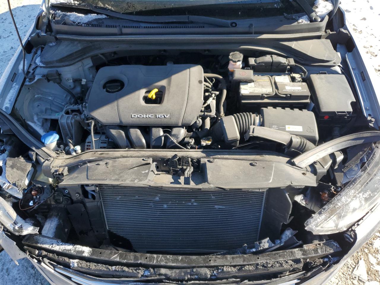 2017 Hyundai Elantra - Image 11