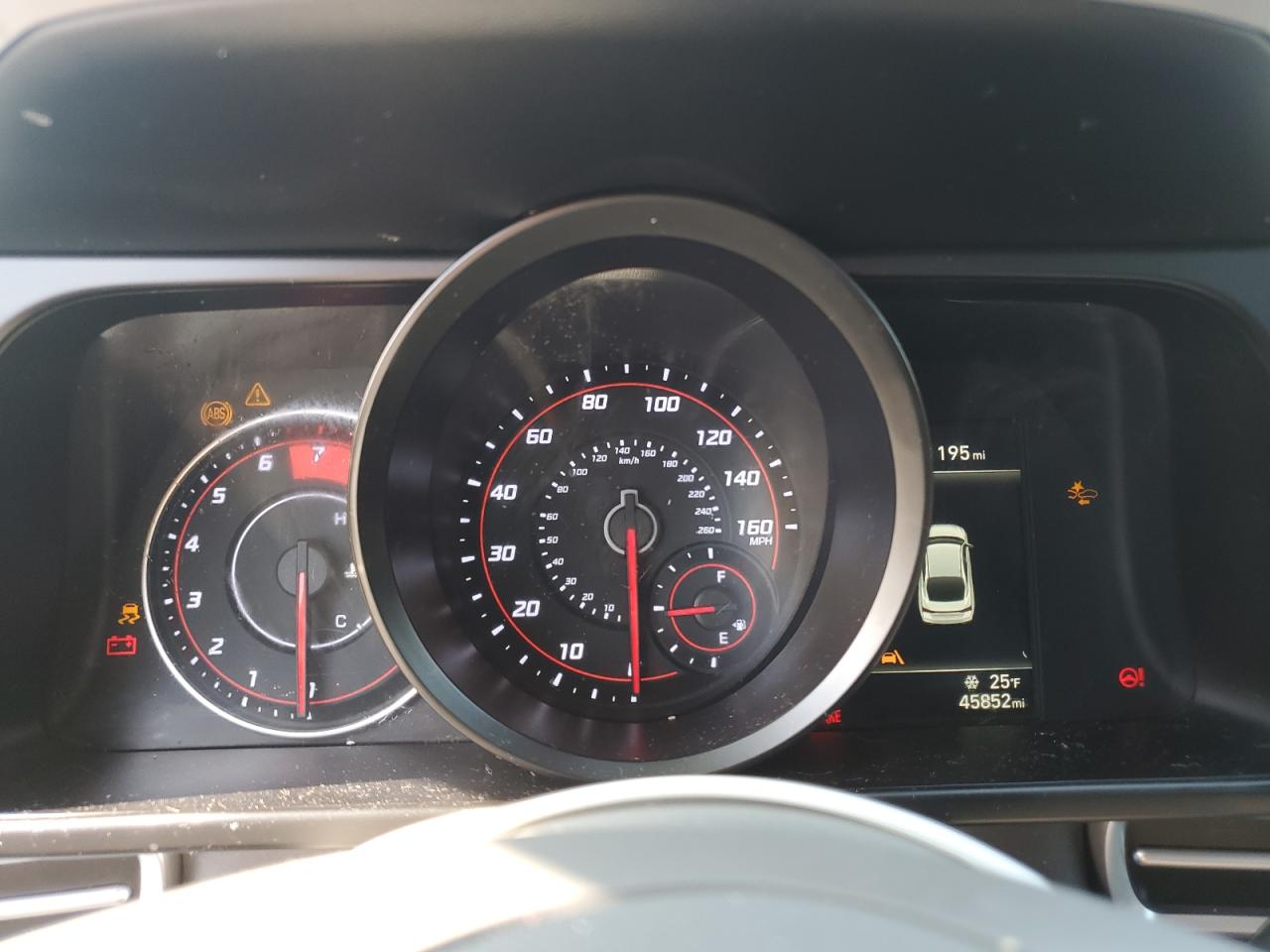 2023 Hyundai Elantra - Image 9