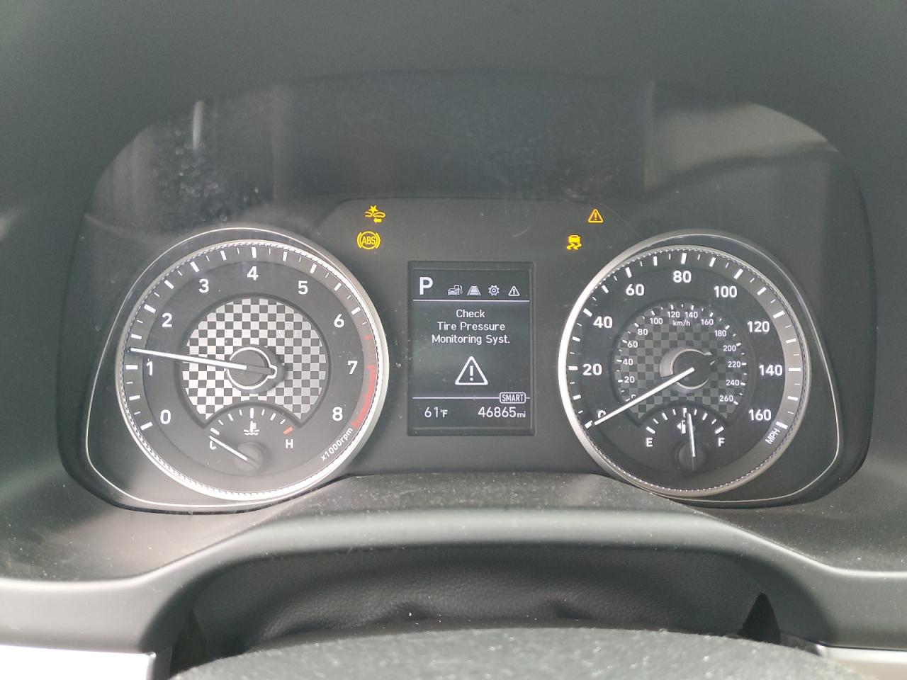 2020 Hyundai Elantra - Image 9