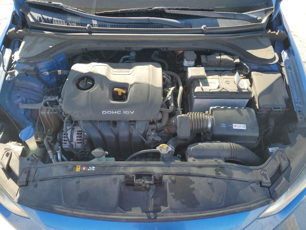 2017 Hyundai Elantra - Image 11