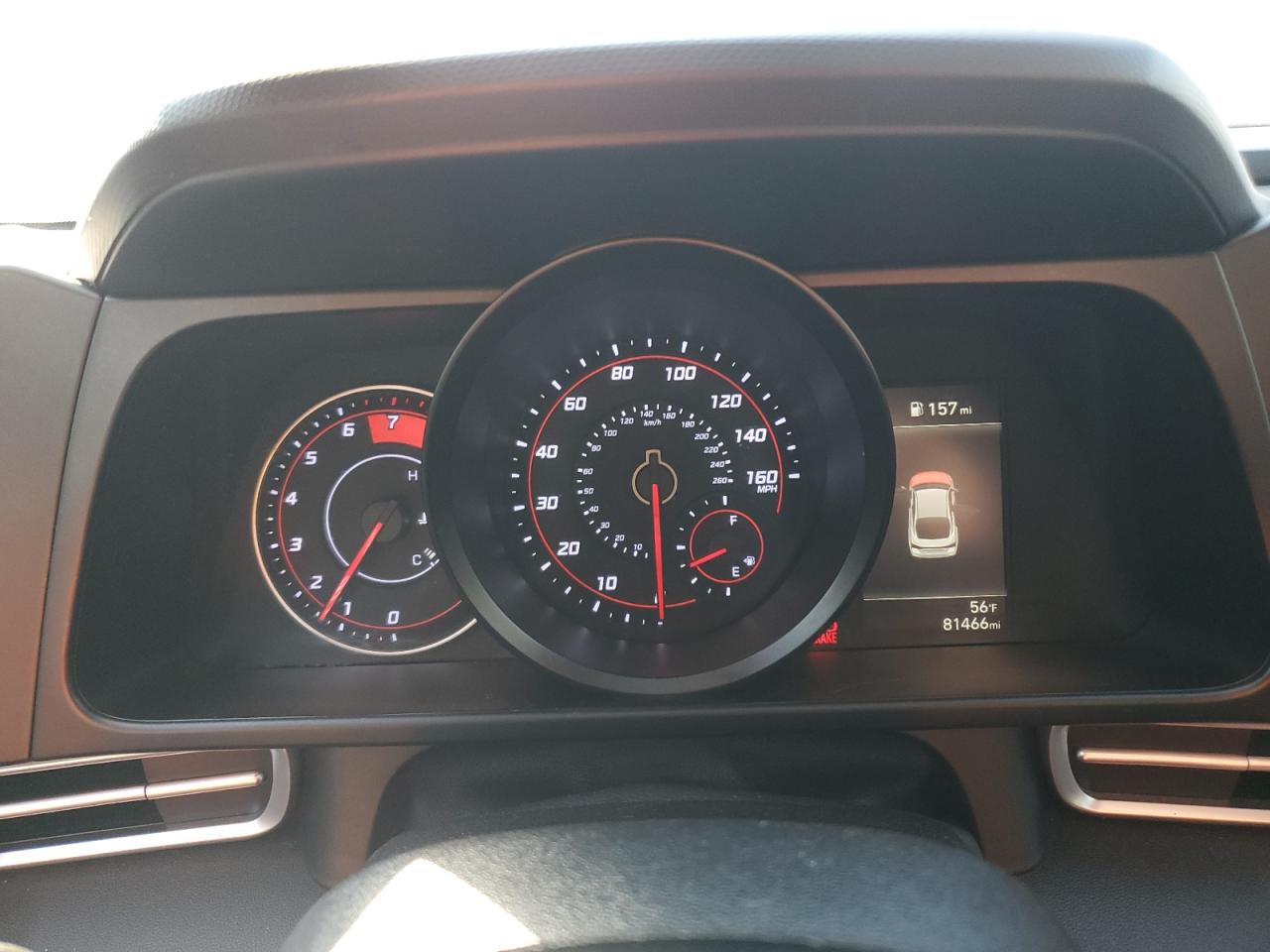 2021 Hyundai Elantra - Image 9