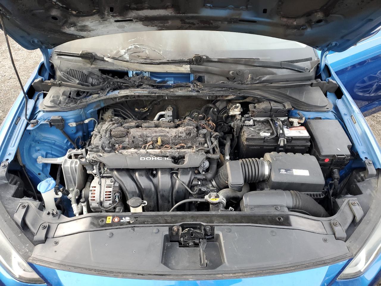 2017 Hyundai Elantra - Image 11