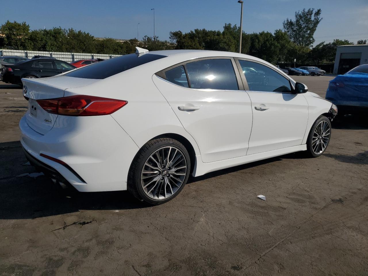 2017 Hyundai Elantra - Image 3