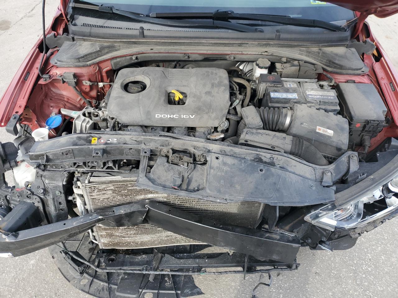 2017 Hyundai Elantra - Image 11