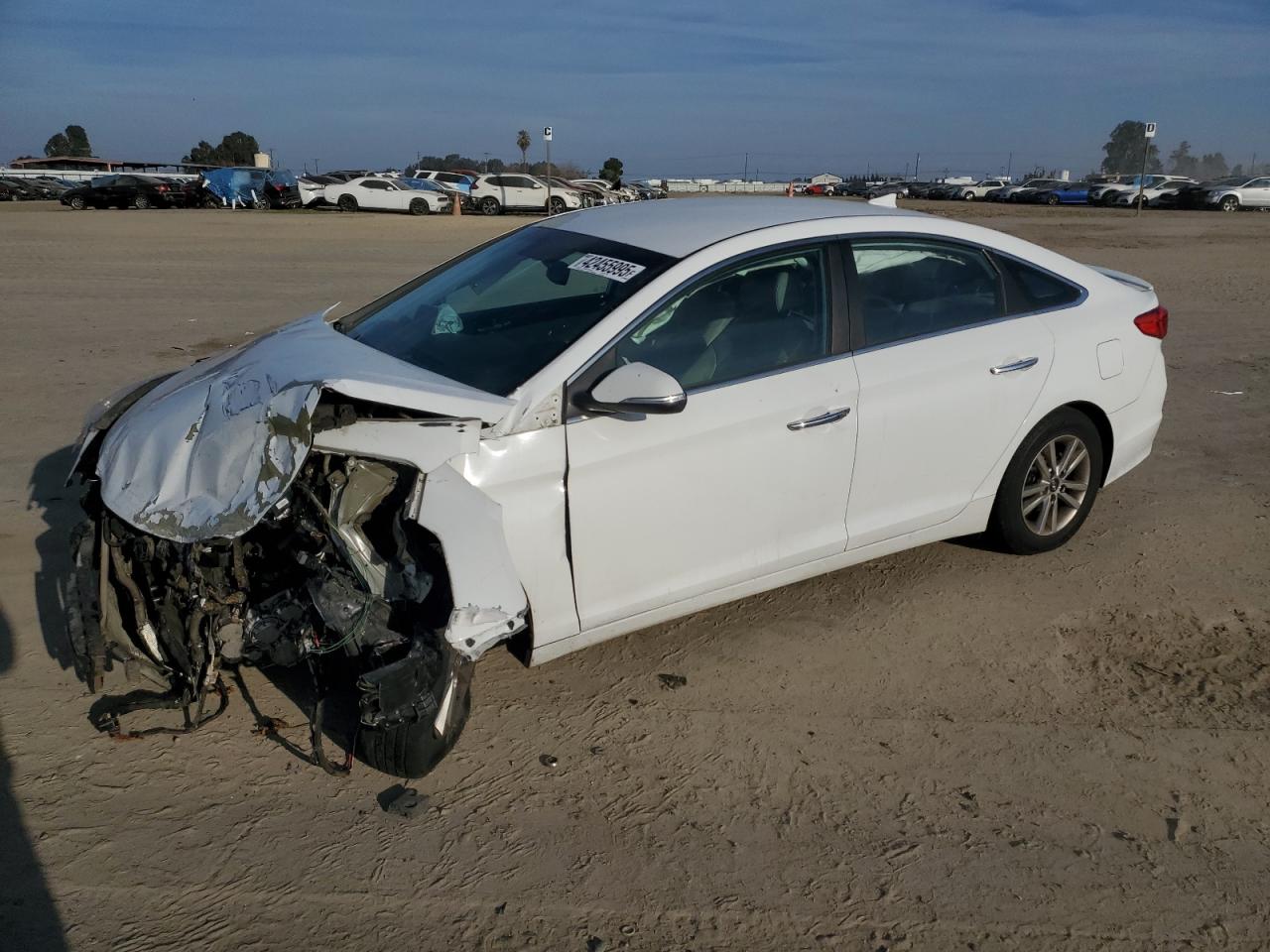 2015 Hyundai Sonata - Image 1
