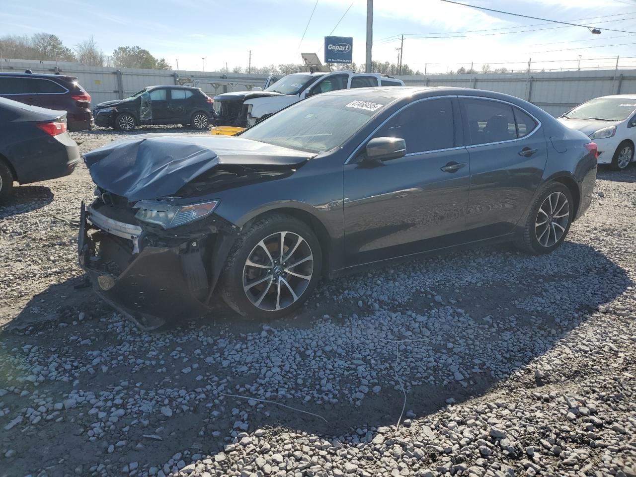 2015 Acura TLX - Image 1