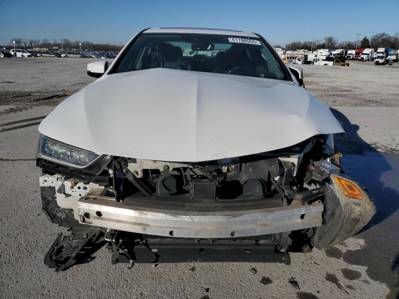 2018 Acura TLX - Image 5
