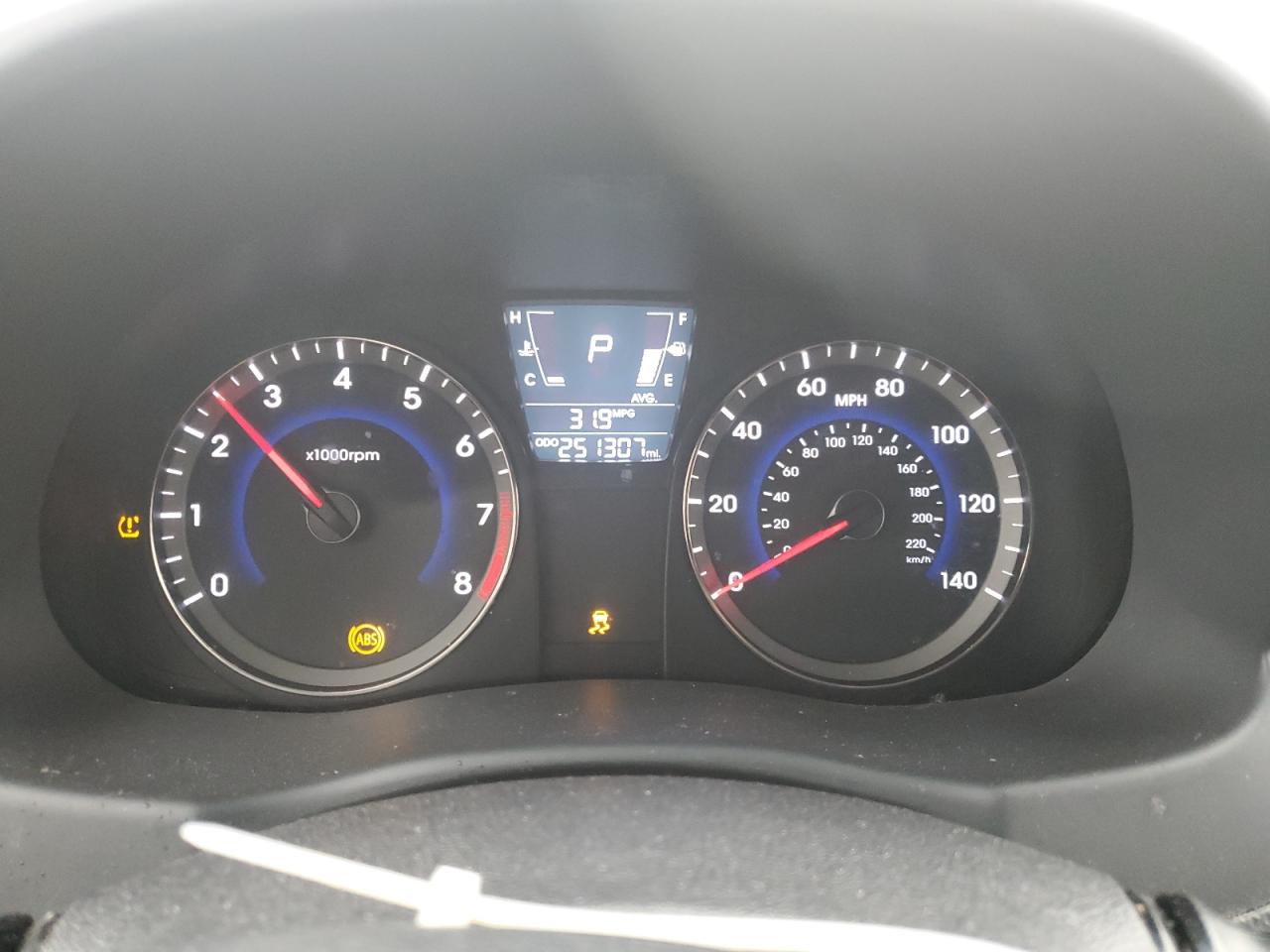 2014 Hyundai Accent - Image 9