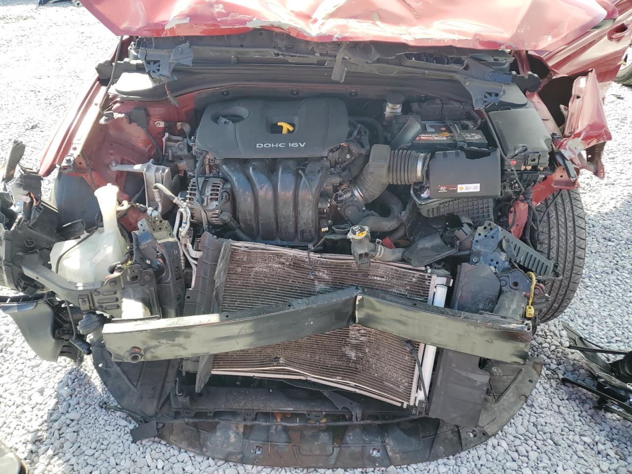 2017 Hyundai Elantra - Image 12