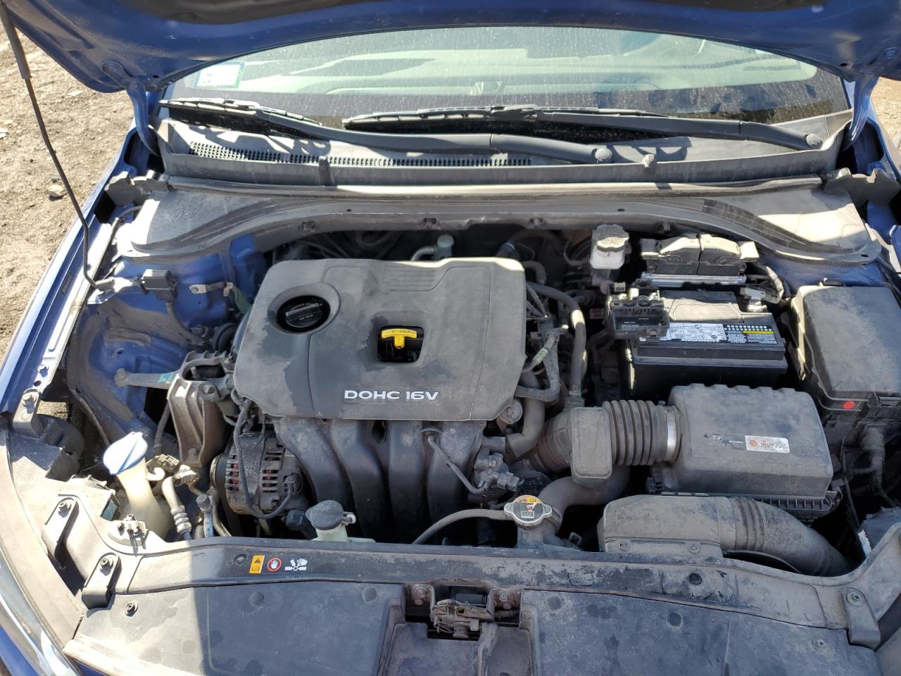2017 Hyundai Elantra - Image 11