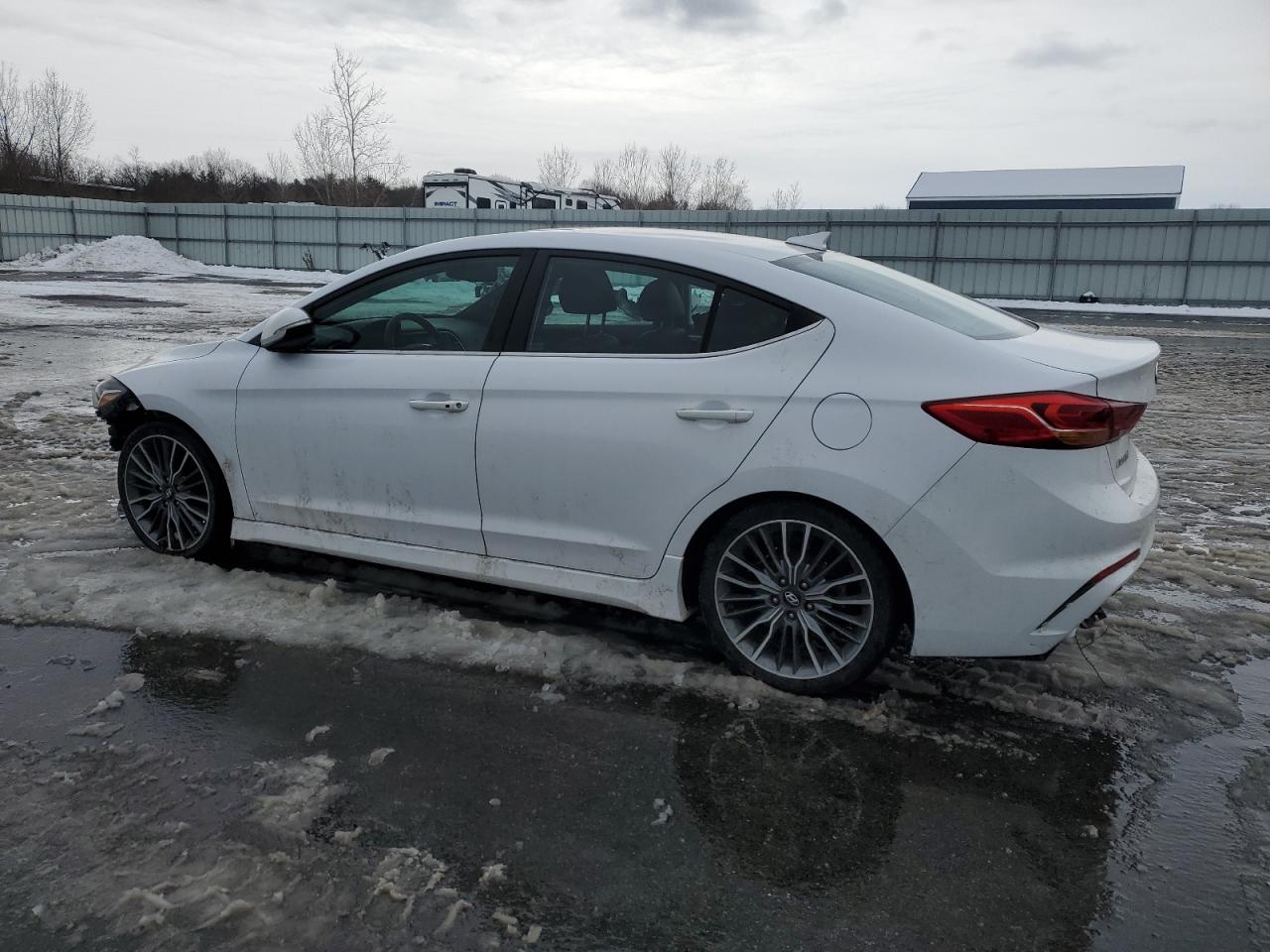 2017 Hyundai Elantra - Image 2