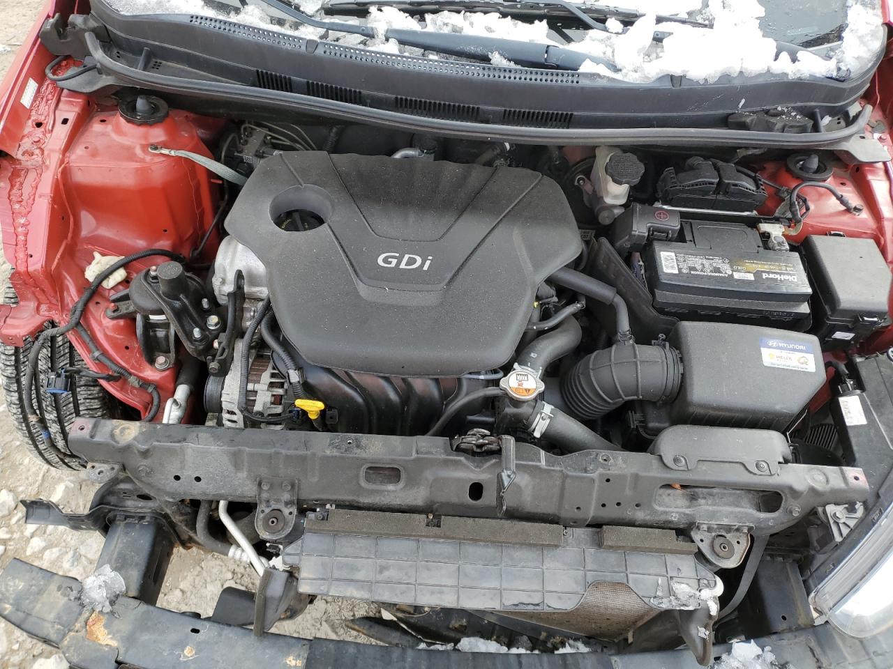 2016 Hyundai Accent - Image 11