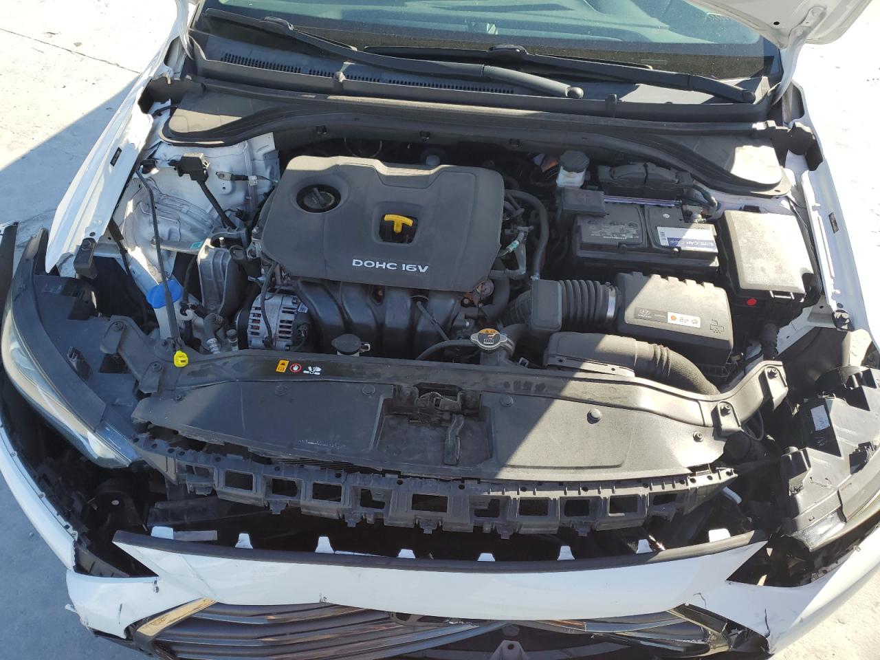 2017 Hyundai Elantra - Image 11
