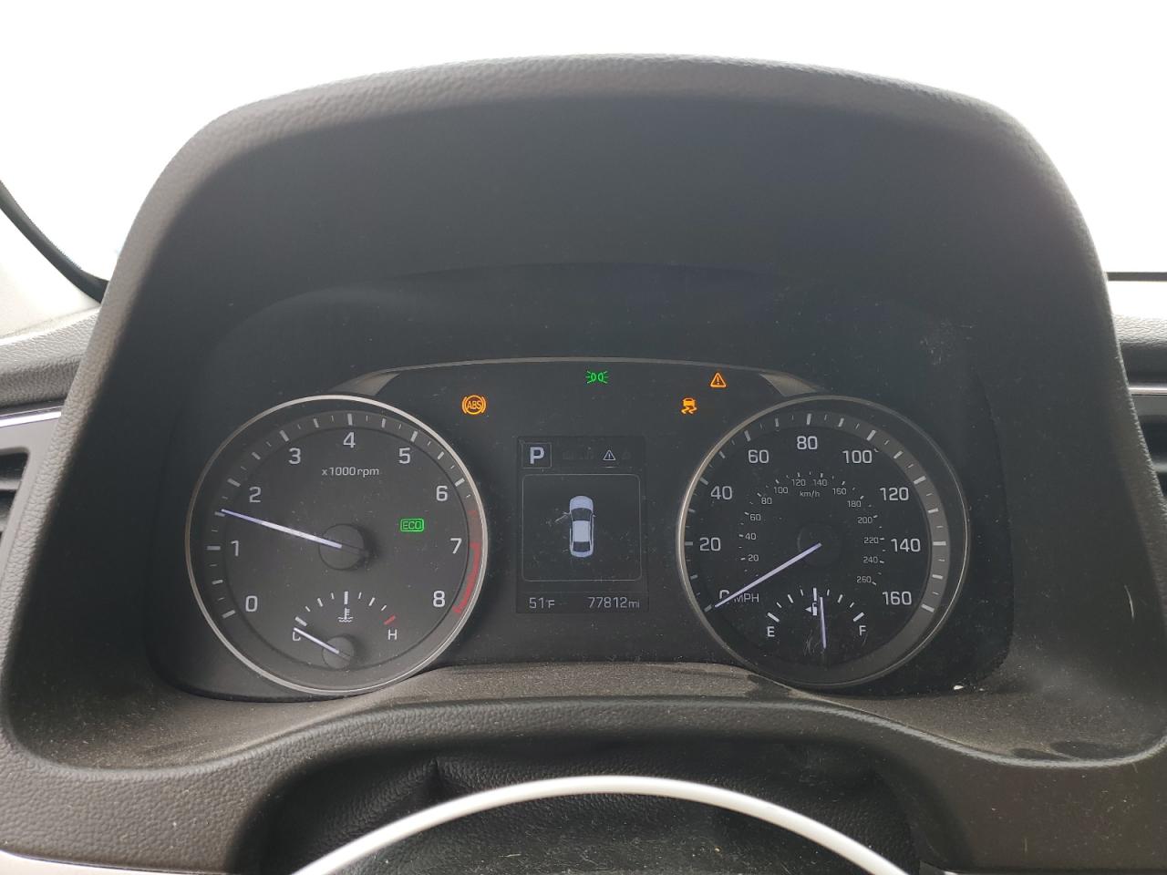 2018 Hyundai Elantra - Image 9