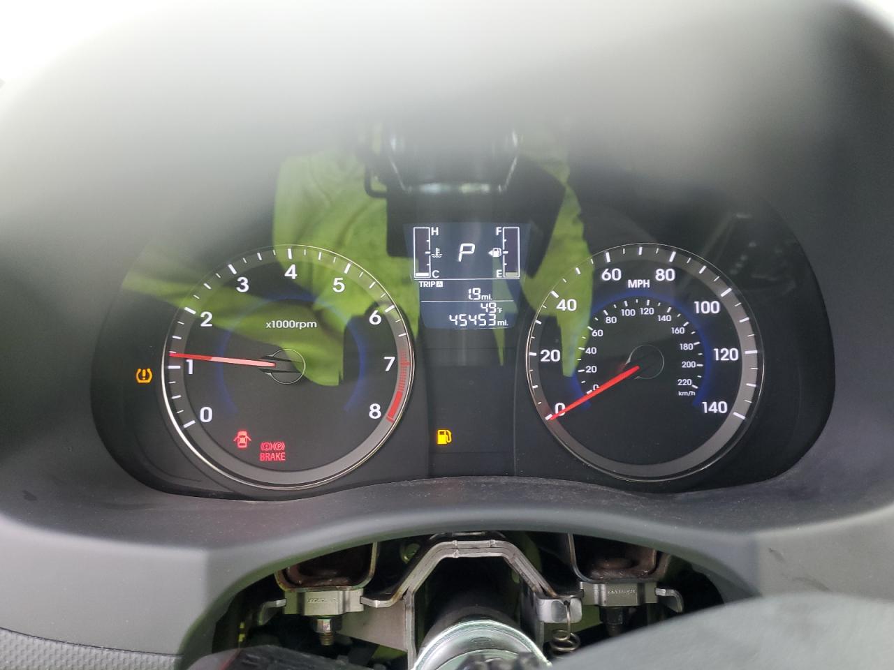 2016 Hyundai Accent - Image 9
