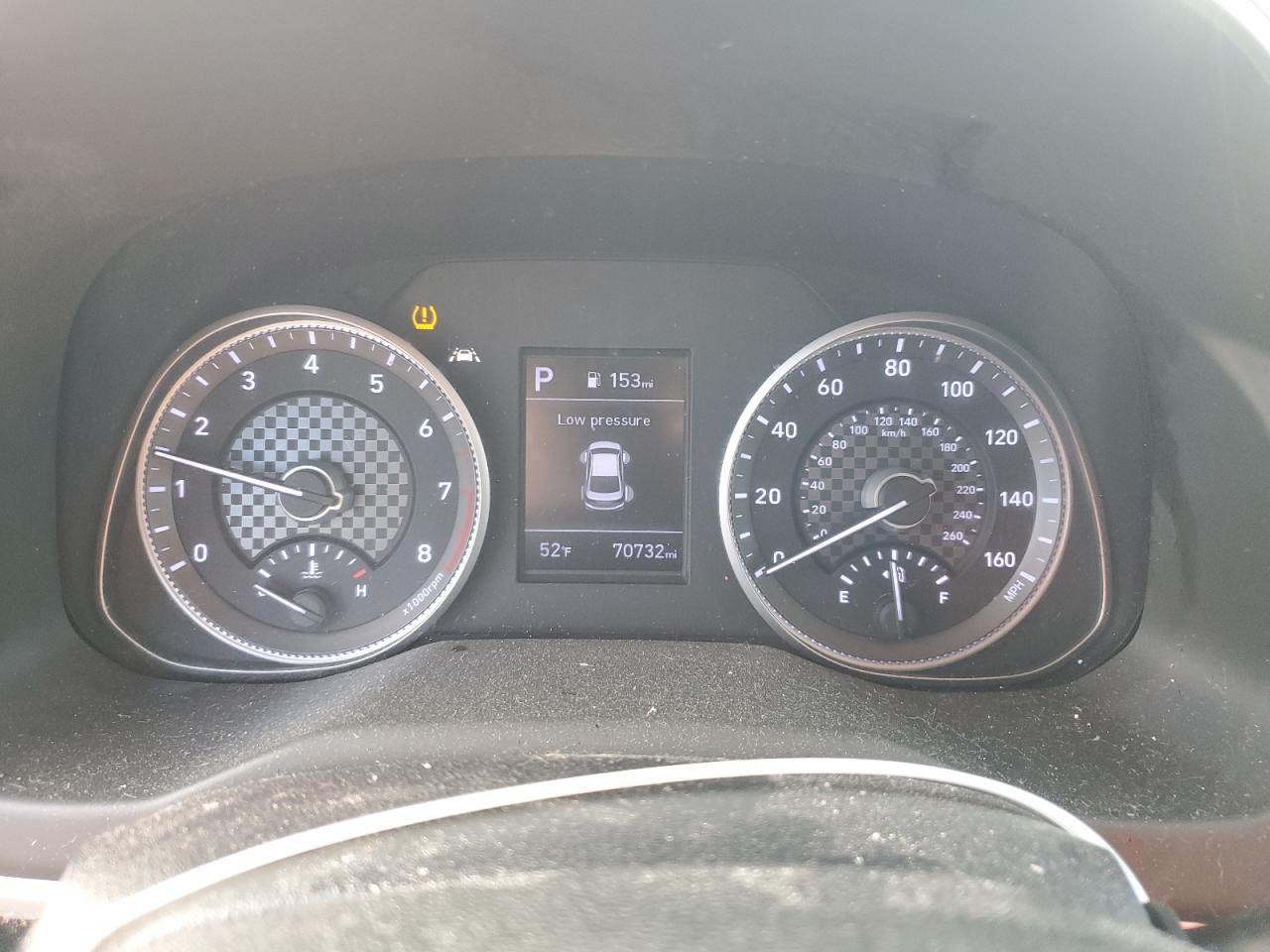 2020 Hyundai Elantra - Image 9
