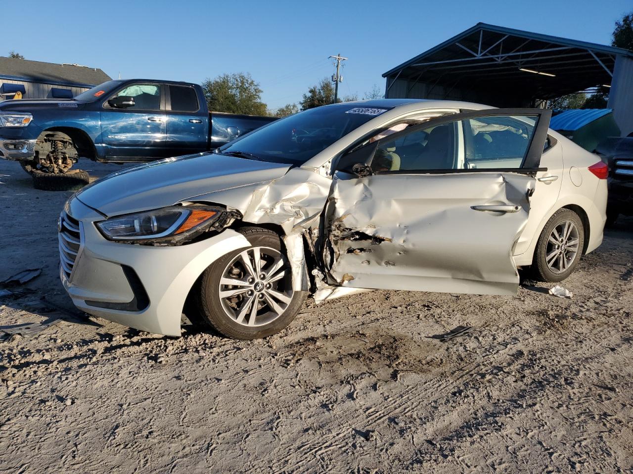 2017 Hyundai Elantra - Image 1