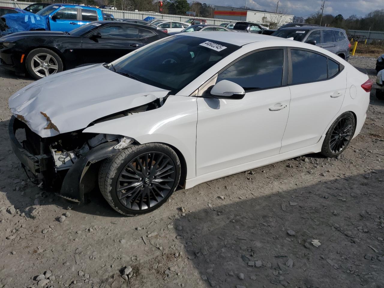 2017 Hyundai Elantra - Image 1