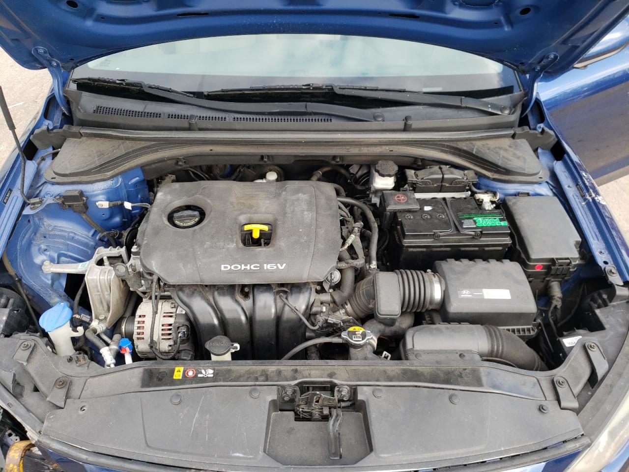 2017 Hyundai Elantra - Image 11