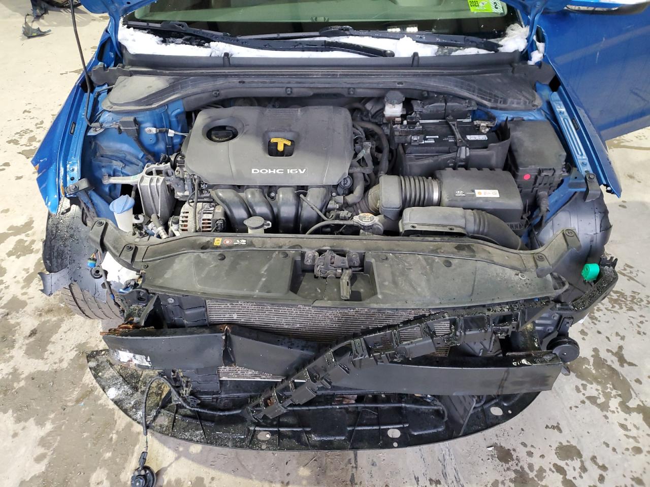 2017 Hyundai Elantra - Image 12