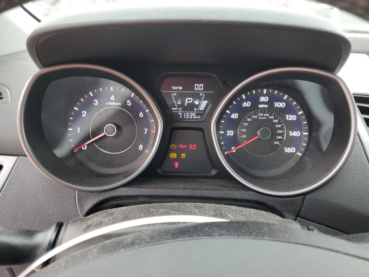 2015 Hyundai Elantra - Image 9