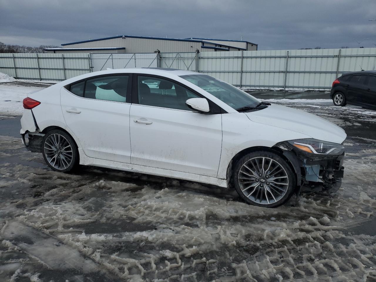 2017 Hyundai Elantra - Image 4