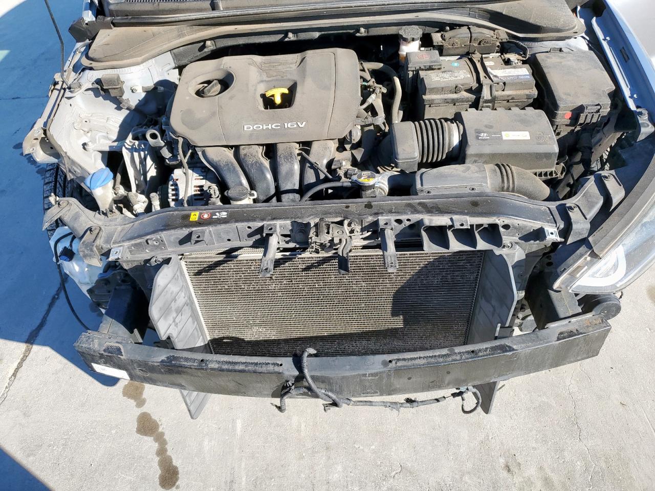 2017 Hyundai Elantra - Image 11