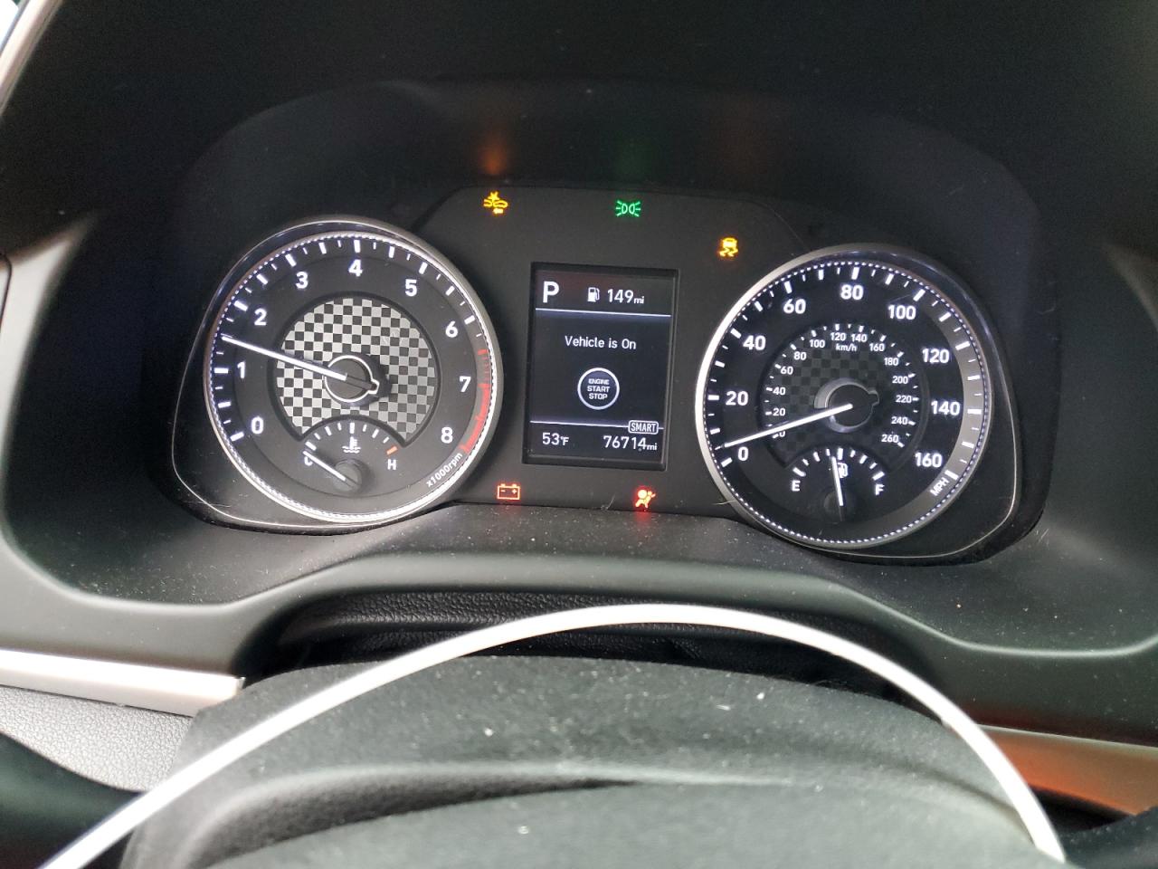 2020 Hyundai Elantra - Image 9