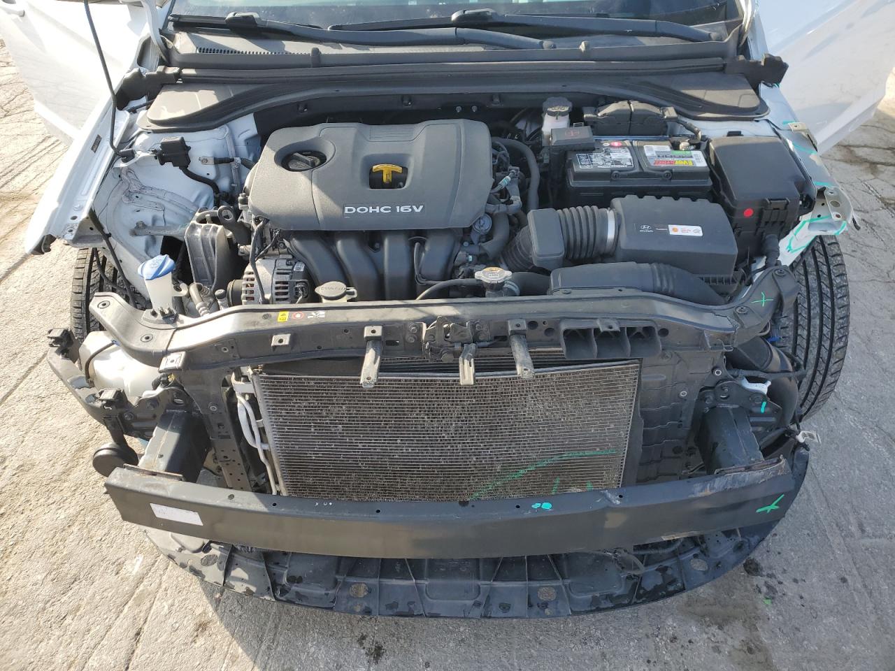 2018 Hyundai Elantra - Image 11
