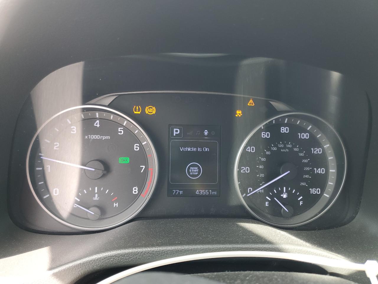 2017 Hyundai Elantra - Image 9